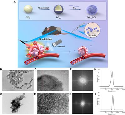 Glutamine coated titanium for synergistic sonodynamic and photothermal on tumor therapy upon targeted delivery